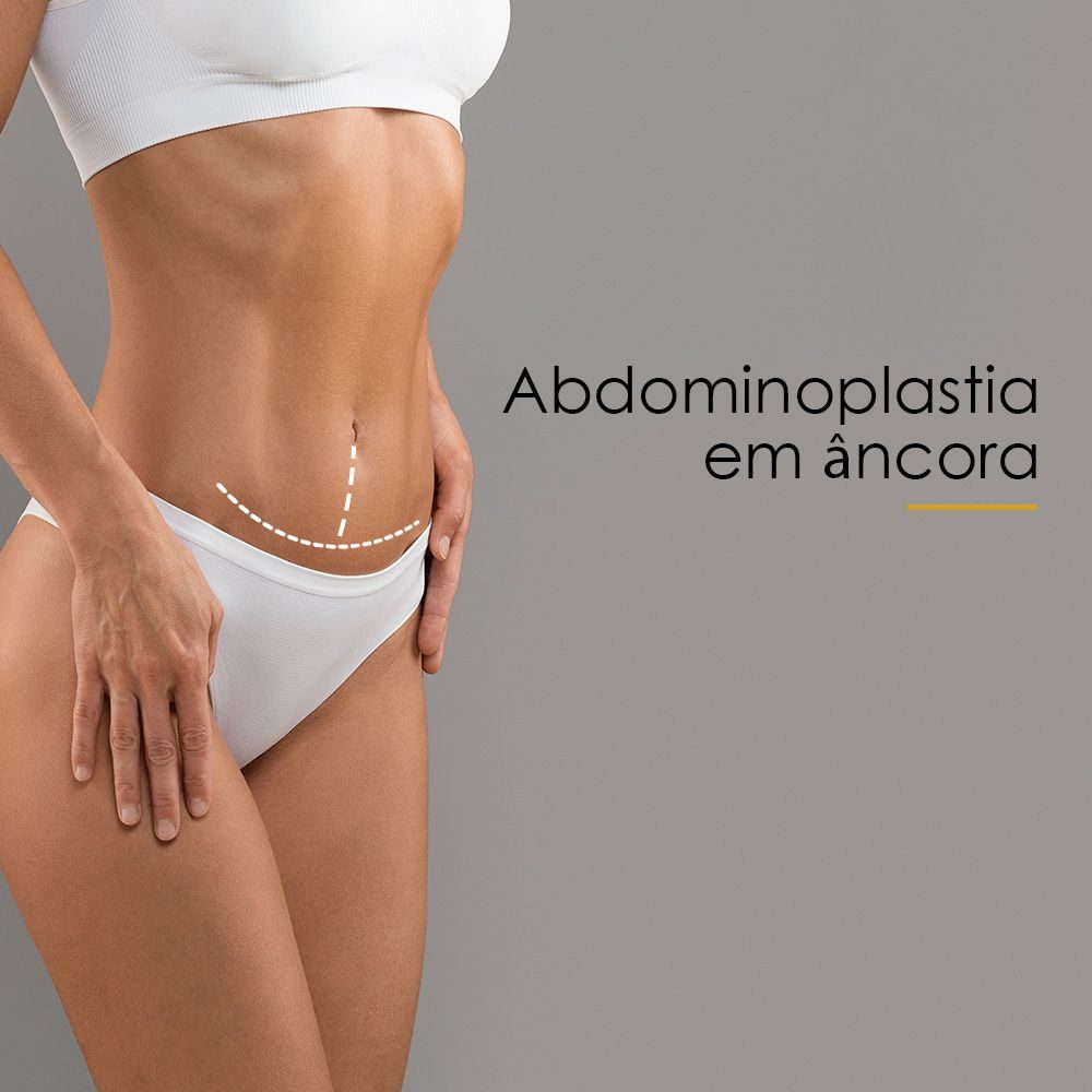 Abdominoplastia em âncora
