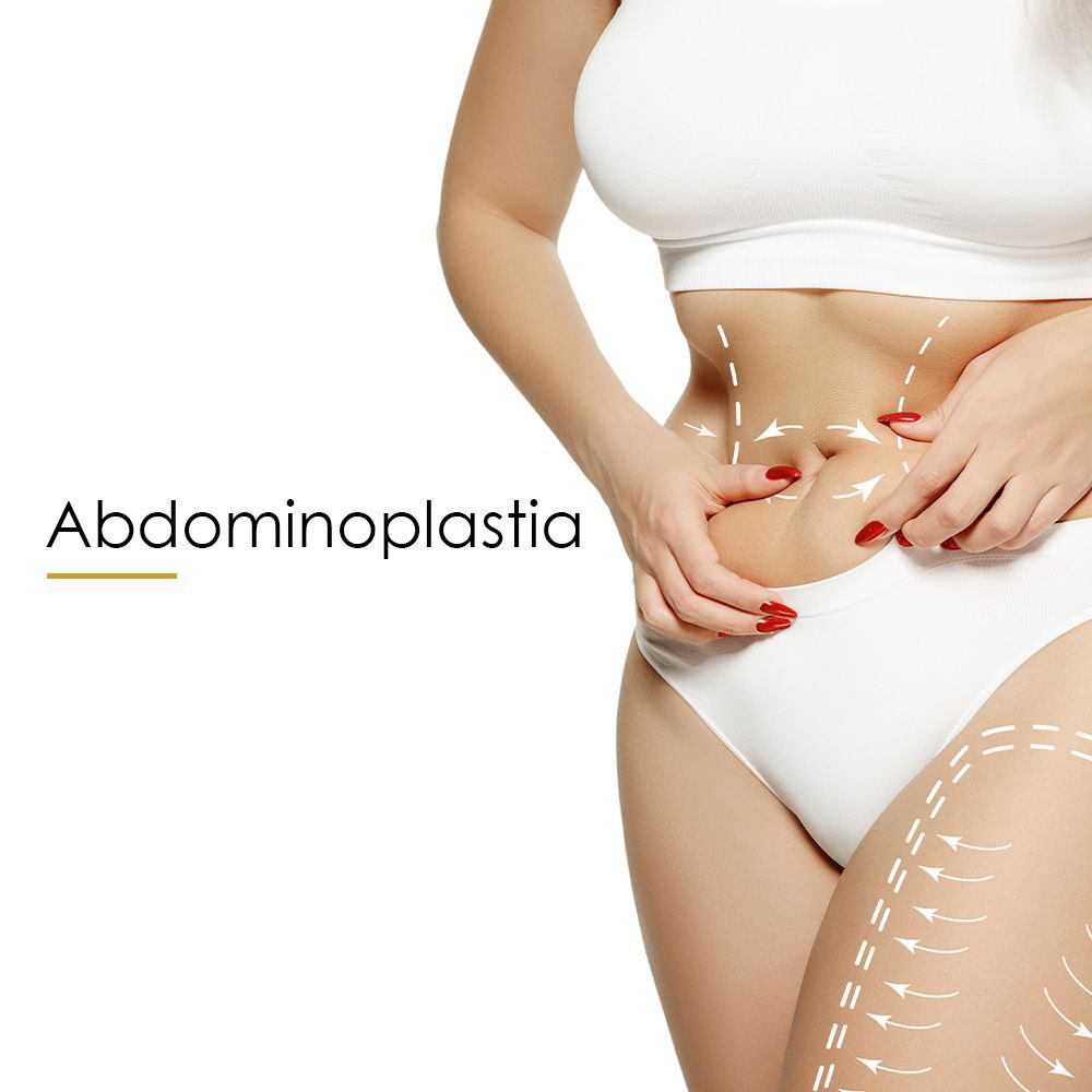 Abdominoplastia