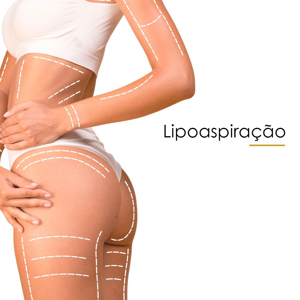 Lipoaspiração_compressed