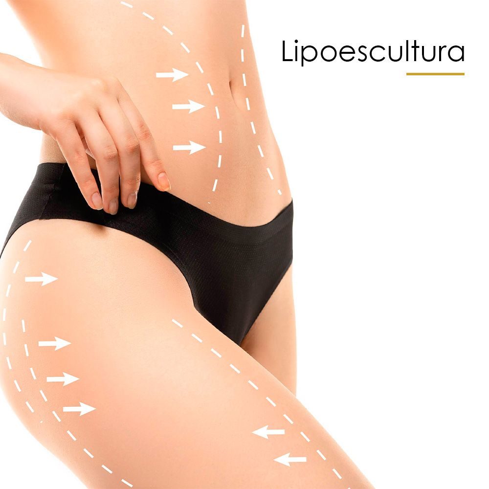 Lipoaspiração_lipoescultura