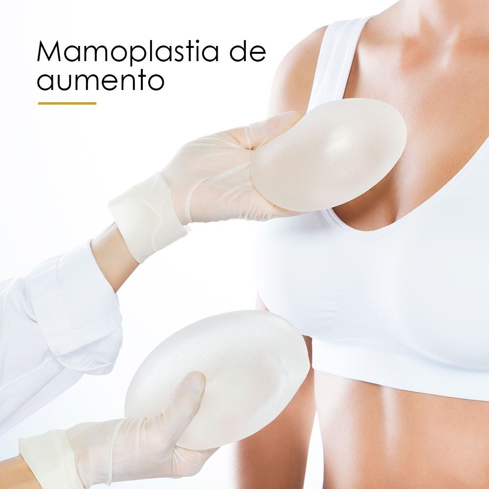 Mamoplastia de aumento