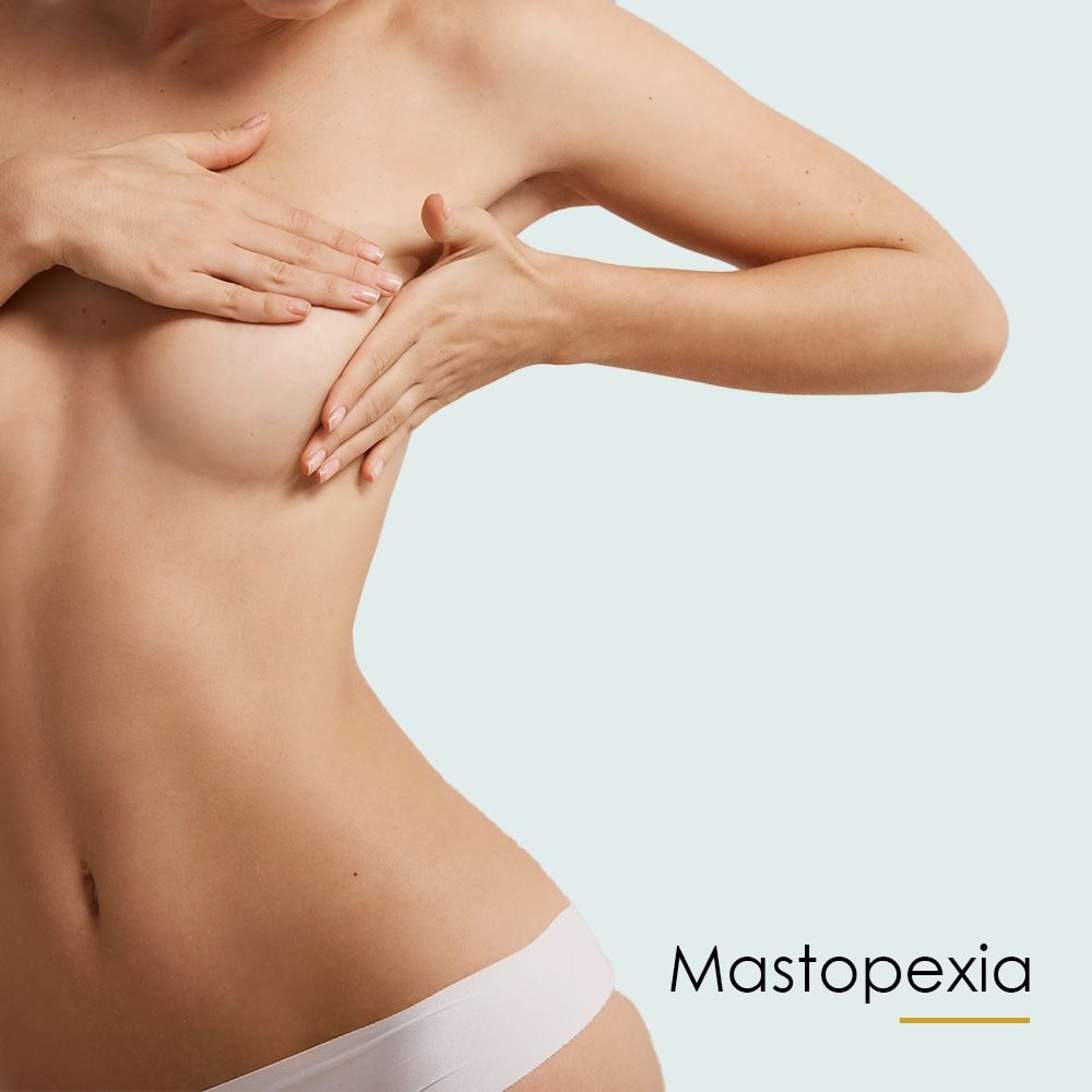 Mastopexia