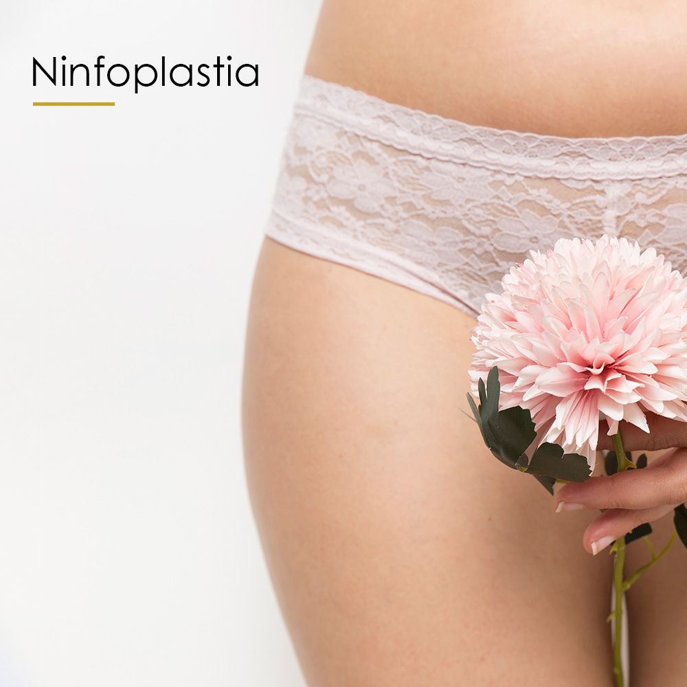 Ninfoplastia_