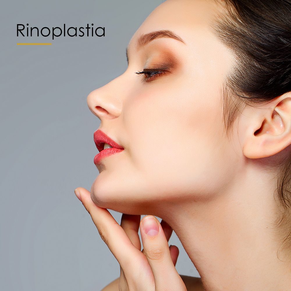 Rinoplastia